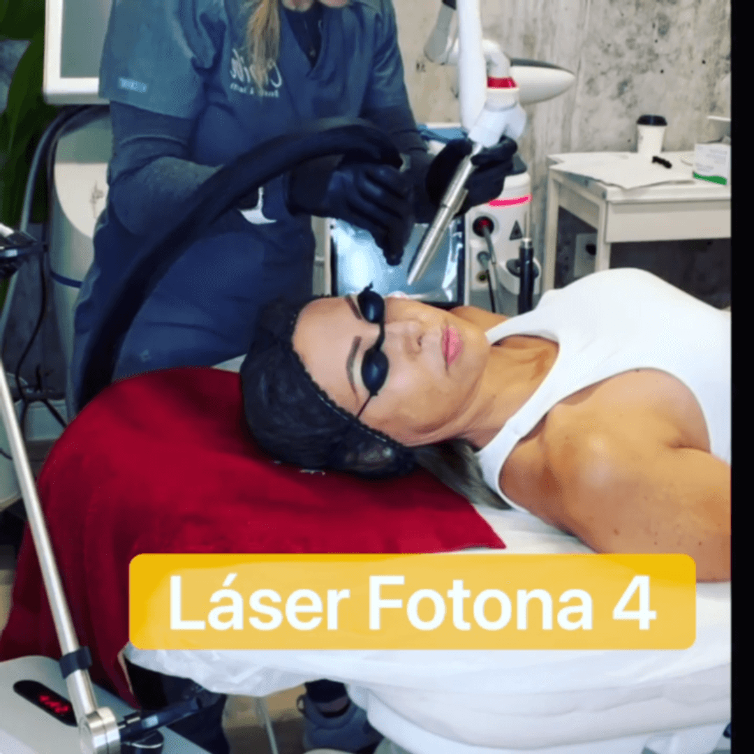 Aesthetic technician performing Fotona 4D laser treatment on female client at Cibibe Beauty & Health.